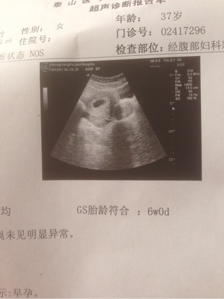胚胎着床出血
