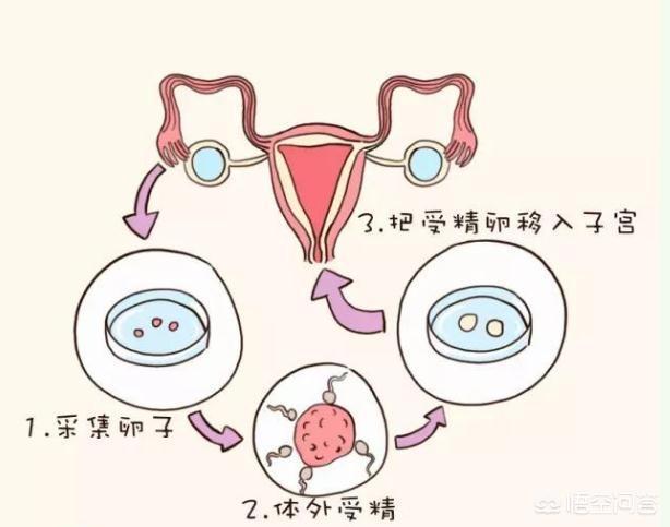 胚胎着床出血